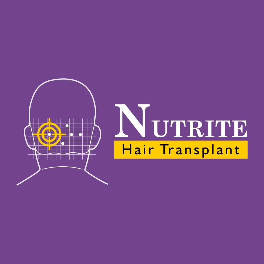 Nutrite Hair Transplant Image