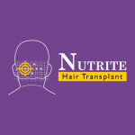 Nutrite Hair Transplant - Ahmedabad